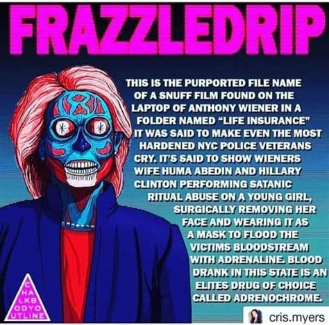 frizzle drip